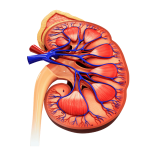 Kidney Stone Removal Kit